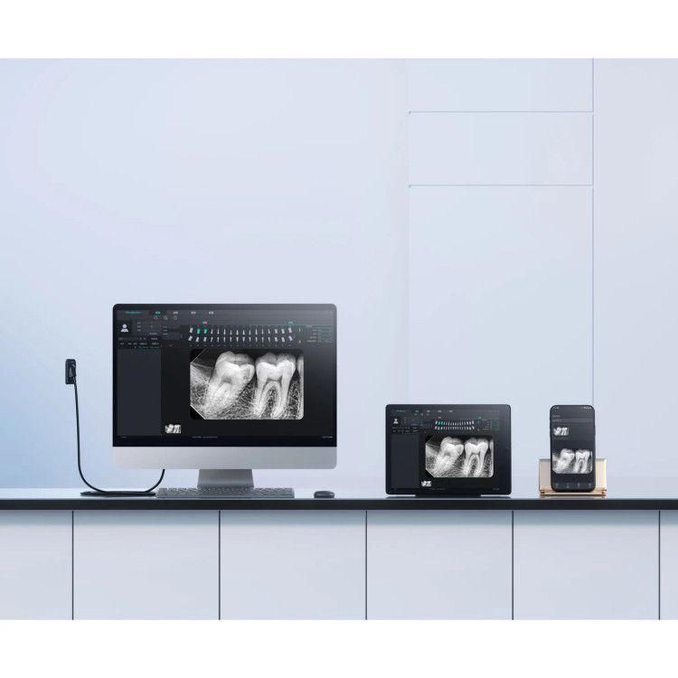 سنسور RVG وودپیکر مدل i-Sensor